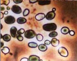 groups of microbes lactic