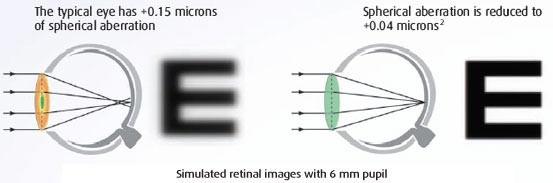 Aspheric Lenses More recently, manufacturers have designed "aspherics" to correct for spherical aberration (SA) of the lens and/or the eye.