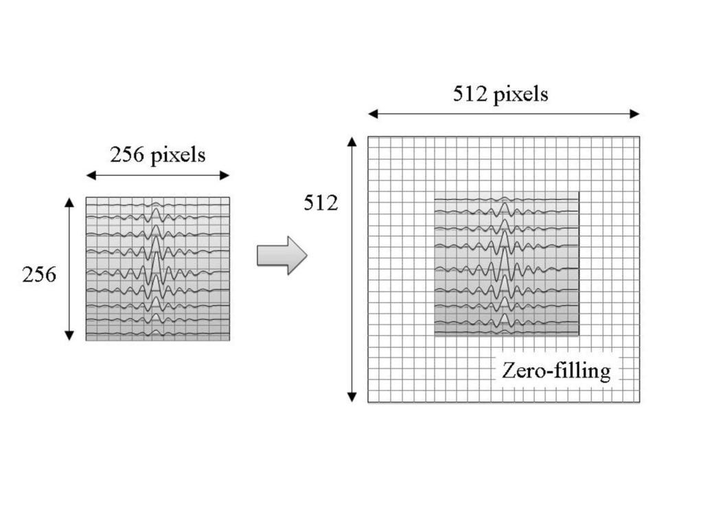 Aims and objectives The zero-filling interpolation (ZIP) technique in magnetic resonance imaging (MRI) is a method that can expand the original matrix size without increasing the scanning time by