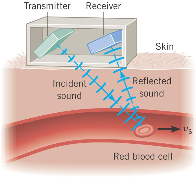 Doppler flow meter When the sound is reflected from the red blood cells, its frequency is changed in a kind of Doppler