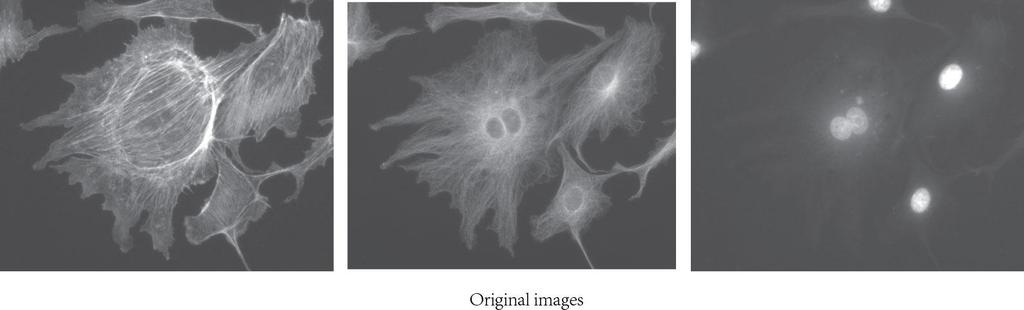 After combining the fluorescence image, [Sharp] function in [Image Processing] can help to get