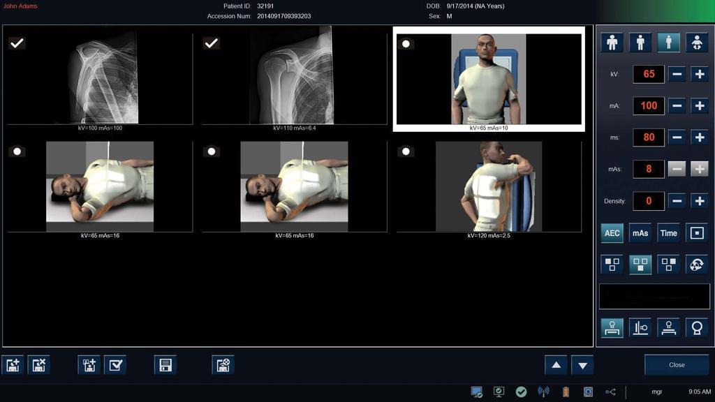 and post processing of acquired images Network connectivity for patient selection DICOM Store, DICOM Print and DICOM Modality Worklist Image