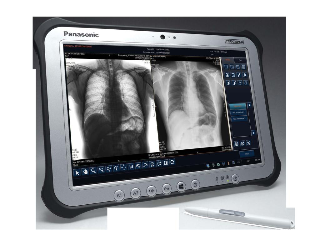 procedure based on Worklist* Automatic patient query to the worklist via bar code reader (option)* Programmable x-ray technique factors for each exam, including APR program and AEC settings with