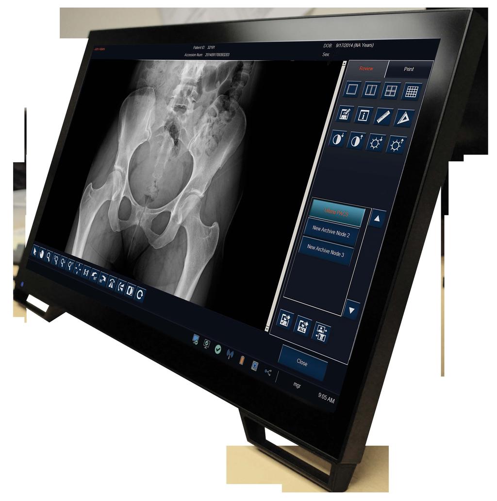 sending images to multiple destinations at the same time The workstation is equipped with a CD burner to export acquired images in DICOM format or in other formats (jpg, bmp, tiff) Supported DICOM