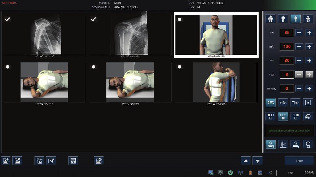 processing of acquired images Network connectivity for patient selection DICOM Connectivity (store, print, MPPS, MWL) Image Stitching (optional) Get more
