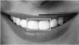 height to width of center two teeth. Ratio of the width of the 2 center teeth to those next to them is φ.