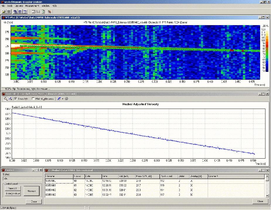 based on verified processing software from Doppler analyzer - Same processing as in WinTrack - Fast processing using high-speed computers and interfaces - Spin processing - Setup screen 3.2.