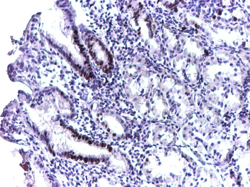În mucoasa gastrică normală, Ki-67 este identificat numai în istmul galandelor gastrice, unde se găsesc celulele stem, singurele celule care proliferează.