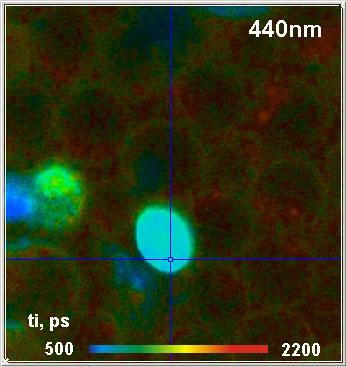 Count Rates in TCSPC FLIM Experiments TCSPC FLIM [3, 6] delivers single- and multi-wavelength fluorescence lifetime images at an accuracy essentially limited by the photon statistics [1, 11], and a