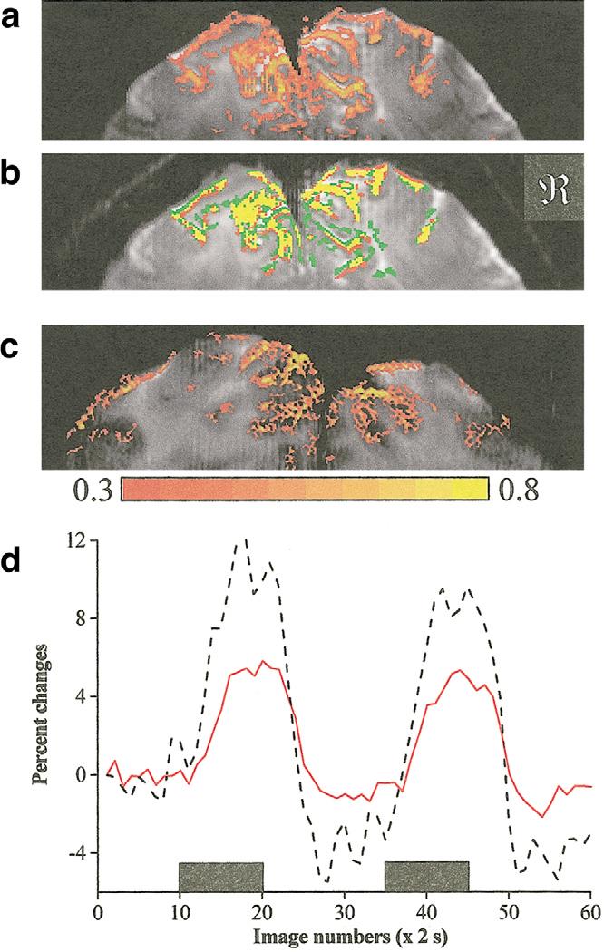 Spin-Echo BOLD and CBF fmri 591 mask) was three to four times smaller than that of the ssir map, again indicating that the BOLD contribution to the SE ssir map was relatively small.