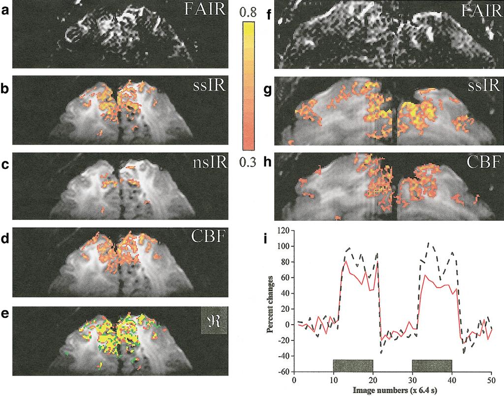 592 Duong et al. FIG. 3. Representative single-shot, SE FAIR studies of the visual cortex at 7 T. a: A FAIR image was obtained by subtracting the nsir from the ssir image.