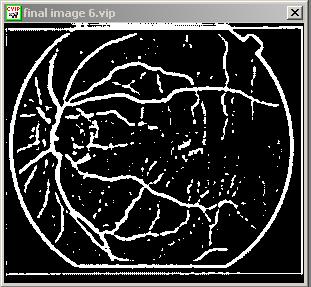 044 Table 1 and Figure 37 show the results of comparing the two algorithms 15 output images to ophthalmologists hand-drawn images using Pratt s Figure of Merit (FOM).
