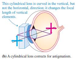 Refractive Errors Astigmatism is not a spherical refractive error and cannot be fully corrected with a spherical lens, but it can be corrected with what is referred to as a cylindrical lens.