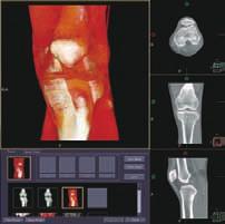 EASY 3D With Alexion s user-friendly 3D imaging software, high quality 3D images can be