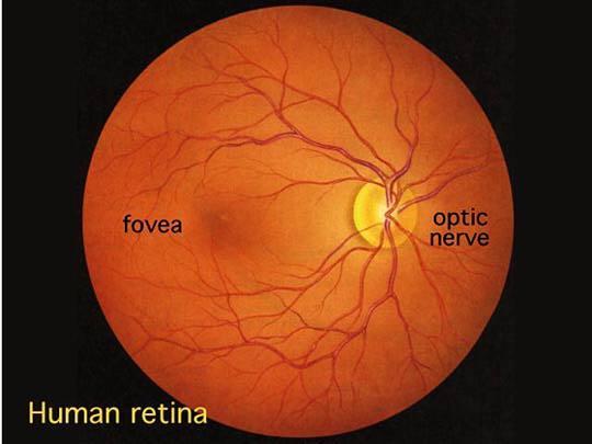 Picture of Retina (Seen