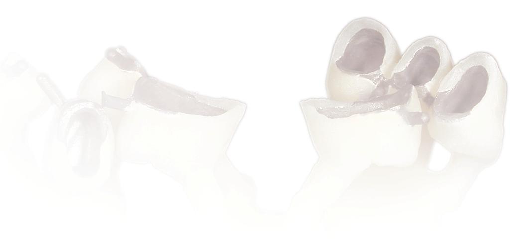 Fig 63: the starting point Fig 64: and the result Fig 65 & 66: Zirconia frames are pressed and then layered with powder.