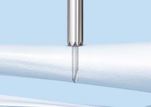The Minimally Invasive Reduction Instruments are intended for obtaining intraoperative fixation using minimally invasive, indirect reduction techniques.