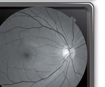 system to incorporate a high resolution retinal