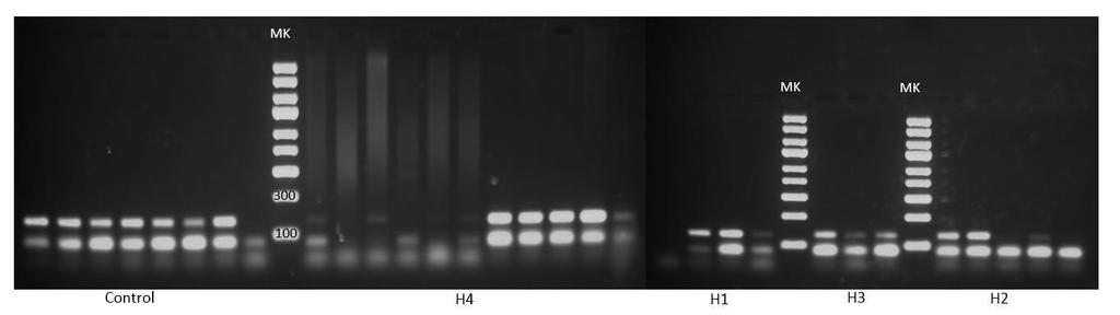 Amplificarea PCR a genei AGT-THR174MET și obținerea fragmentului de interes de 303pb (Mk=Marker ADN SM1551 Fermentas) Fig. 11.
