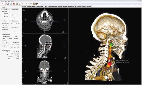 Useful for landmark identification or anatomy examinations, the annotations dynamically adjust with the volume renderings on both the Anatomage Table and Invivo software.