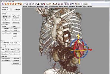Perform and Capture Simulations Segment any patient scan data and create digital models.