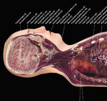 Annotations Over 1000 structures of gross anatomy are fully annotated and segmented.