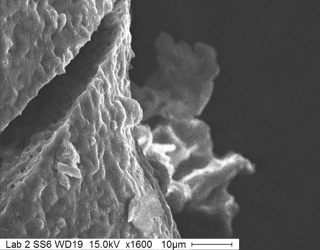 Figure 3. Favorite Image: Secondary electron image of uncoated lichen.