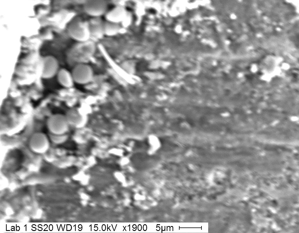 Figure 1b. Secondary electron image of debris on sputter coated gastropod shell.
