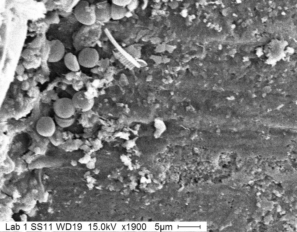 Figure 1c. Secondary electron image of debris on sputter coated mollusk shell.