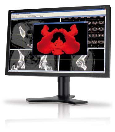S-IPS technology has become the de-facto standard for use in multi-display medical applications such as PACS, especially where displays are used in portrait mode.