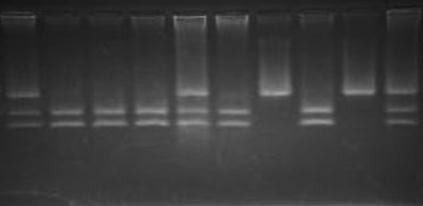 57 Kết quả xác định đa hình T6235C của gen CYP1A1 bằng PCR RFLP M ĐC 1 2 3 4 5 6 7 8 9 340bp 200bp 140bp Hình 3.2. Sản phẩm sử dụng enzym cắt vùng T6235C của gen CYP1A1 bằng enzym MspI.