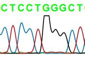 Nhận xét: Sản phẩm cắt đoạn vùng T6235C trên gen CYP1A1 bằng enzym MspI trên các mẫu bệnh nhân ung thư phổi và nhóm chứng