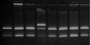 77 Kết quả xác định đa hình G4268C của gen CYP2D6 bằng PCR RFLP M ĐC 1 2 3 4 5 6 7 332bp 229bp 103bp Hình 3.8. Sản phẩm sử dụng enzym cắt vùng G4268C của gen CYP2D6 bằng enzym Eco91I.