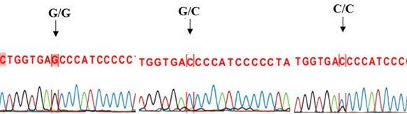 Nhận xét: Sản phẩm sử dụng enzym cắt đoạn vùng G4268C trên gen CYP2D6 bằng enzym Eco91I trên các mẫu bệnh nhân ung thư phổi và nhóm chứng có kích thước khác nhau phù hợp với tính toán lý thuyết.