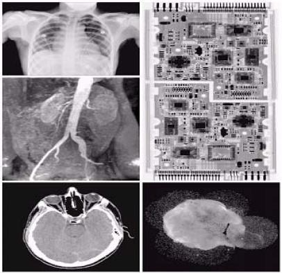 X-ray Imaging Medical diagnostics (a) chest X-ray (familiar) (b) aortic