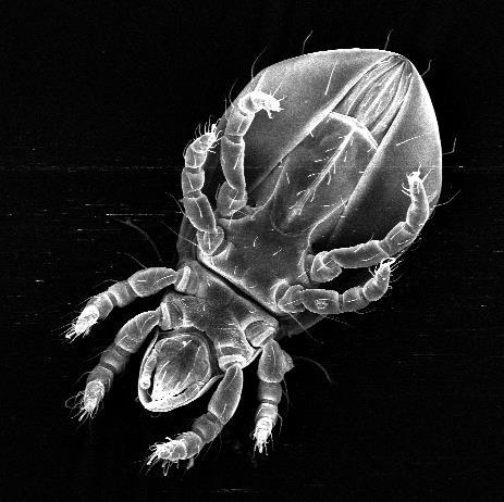 These images show amazing contrast and surface detail of the mite.
