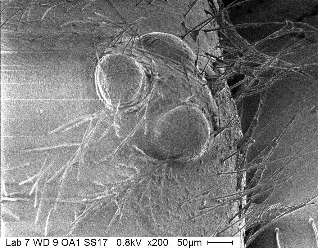 Figure 11: Scanning Electron micrograph of a fly head for low kv imaging of an uncoated sample. Image was taken at a working distance of 9mm and an aperture of 1.