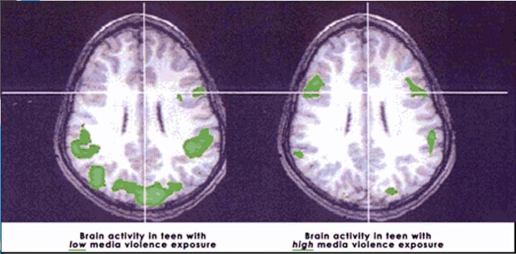 Media Violence Update Indiana University Brain Scan Research The brain scans on the right show that media violence stunts or "retards" kids' brain development: children with violent TV, movie, and