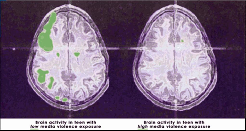 Media Violence Update Indiana University Brain Scan Research This second set of brain scans shows brain activity during a decision making exercise, called Go No Go.