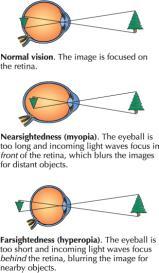 iris pupil cornea lens Blind spot retina sclera or fovea Psychology & Life Vision research