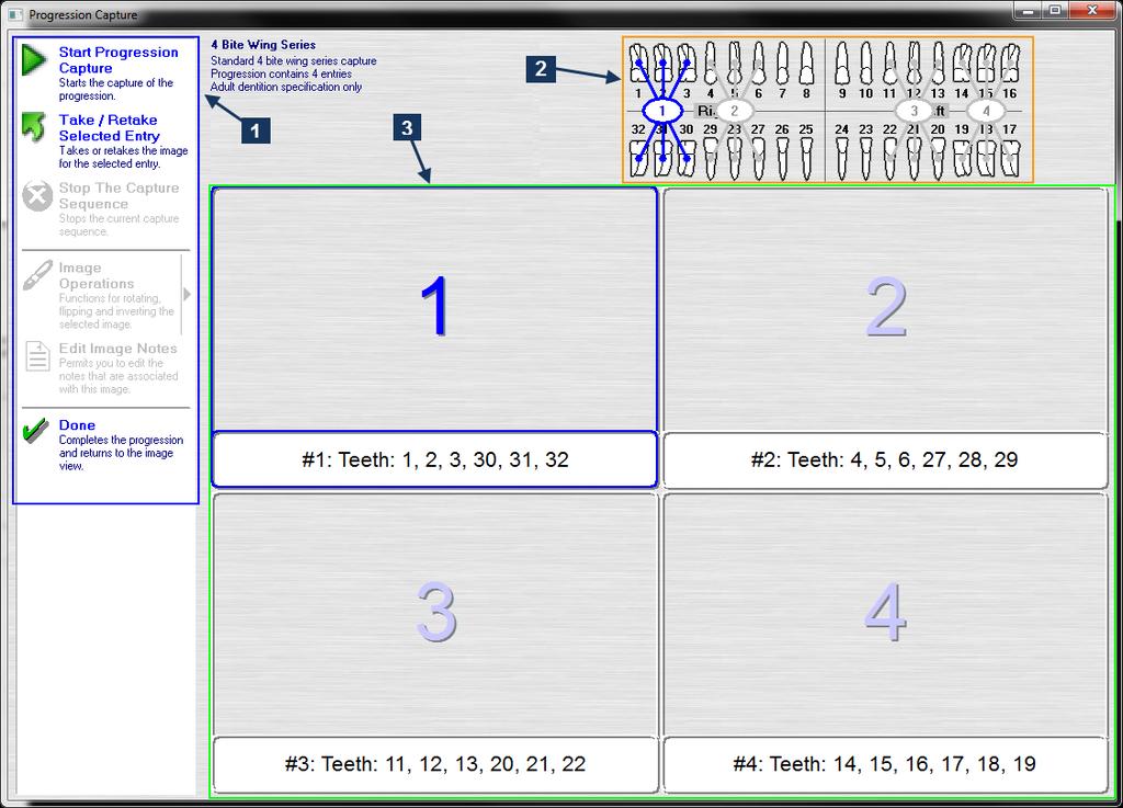 4 PROGRESSION CAPTURE 4.1 General Information A progression is a grouping of study related intra-oral images, instead of a rigid arrangement of images found in traditional layout-style mounts.