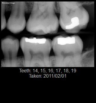 If images from multiple patients are currently displayed, each patient s Name, ID number, Age, and Gender are displayed along with the teeth associated with the image and the taken date, seen in the
