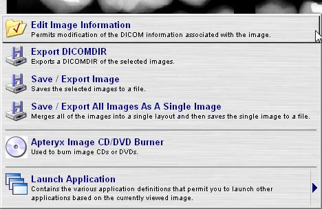 The DICOM Tag button displays every piece of DICOM information associated with a single image.