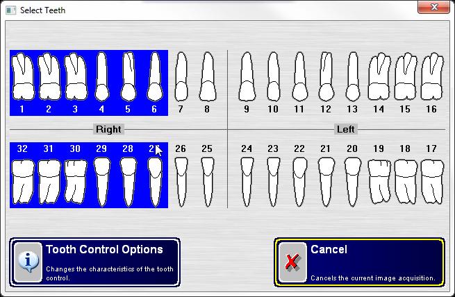 Select one or more teeth to associate with the image after the capture is complete.