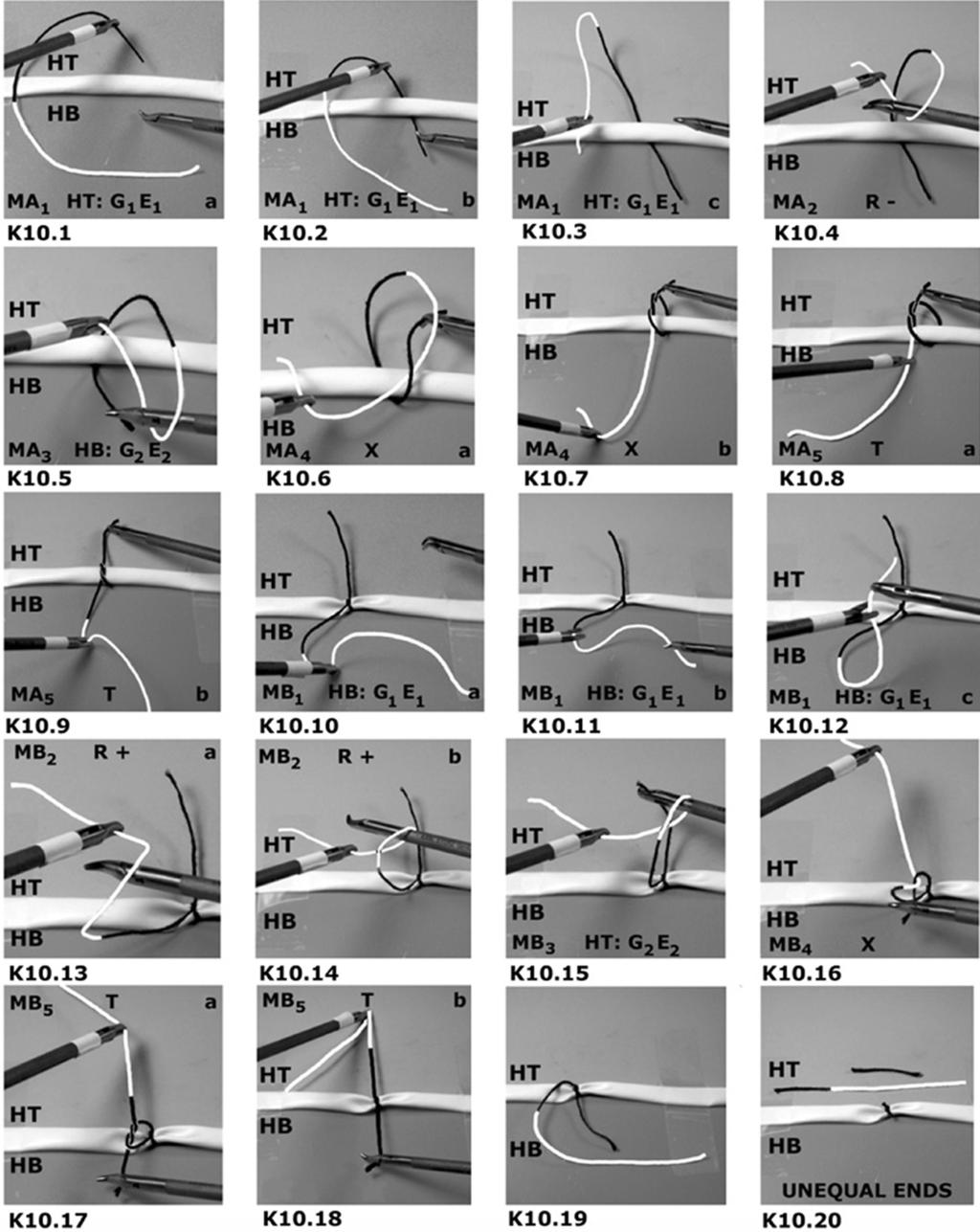 These formed the bases for the open surgery squareknot tying analysis performed in this study. 1 CONCLUSION Figure 7. Laparoscopic intracorporeal square knot 10 (unequal lengths unequal rotations).