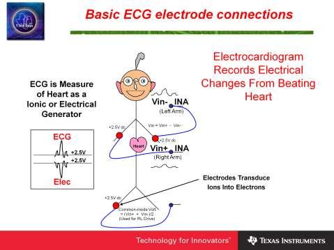 For ECG applications three or more electrodes are placed on the body. The diagram shows one of the most commonly used connections between the body and ECG equipment.