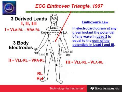 The ECG Einthoven triangle dates back to the earliest days of electrocardiography and provides the basis for electrode placement.