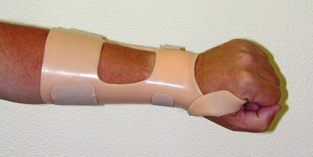 Rigid Multicast Rigid is a strong low-temperature thermoplastic material that follows the exact contours of the treated surface. After processing it transforms into a hard splint.