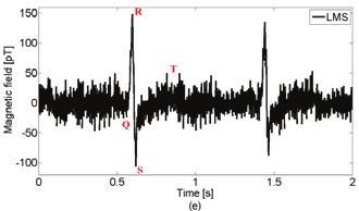 The environmental magnetic noise was linearly filtered to produce a correlated noise which was used as the reference signal input to the noise canceller, as illustrated in Fig.