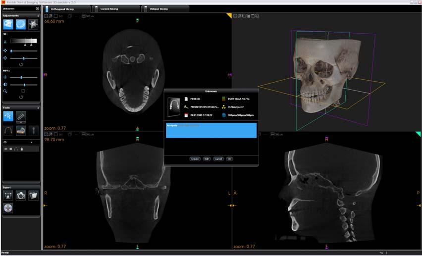 X-Ray Dose Emission Information X-Ray Dose Emission Information Compliance with EURATOM 97/43 Directive Display the image in the 3D viewer, click on the menu bar next to the patient s name.